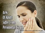 Symptoms-Of-Gum-Disease