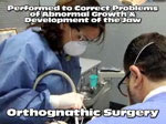 Orthognathic-Surgery
