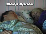 Sleep Apnea
