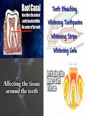 resources-stephen-wolpo-dds-smile-sensations--implants-invisalign-gum-disease-stamford-ct