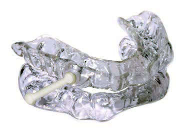 Cure-For-Snoring-5-cosmetic-dentist-stephen-wolpo-dds-smile-sensations--implants-invisalign-gum-disease-stamford-ct