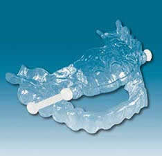 SilentNite-cosmetic-dentist-stephen-wolpo-dds-smile-sensations--implants-invisalign-gum-disease-stamford-ct