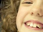 when-should-children-get-braces