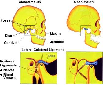 bruxism-tmj-consequence
